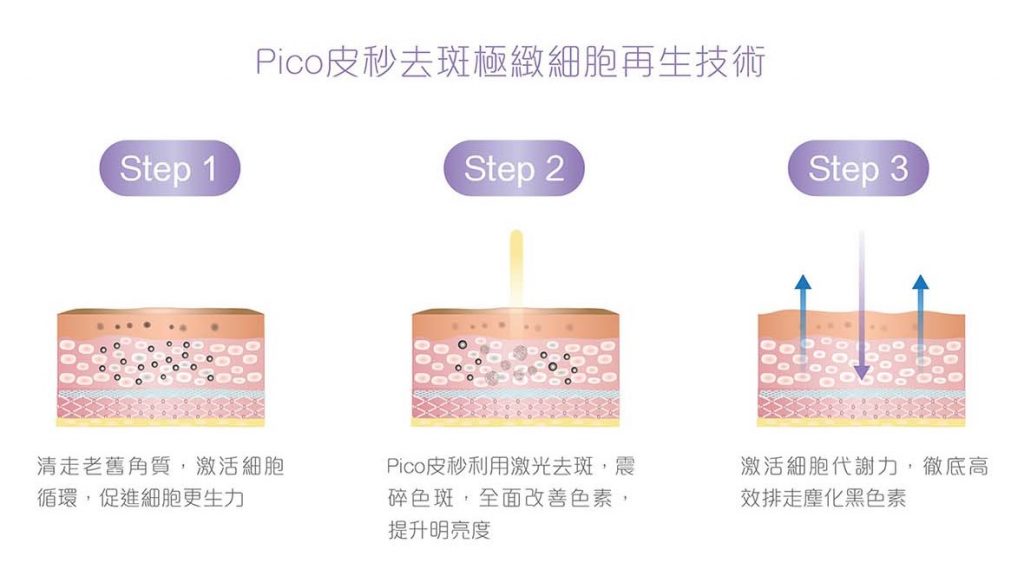 Pico皮秒去斑極緻細胞再生技術，第一步清走老舊角質，第二步極速碎斑，第三步高效排走塵化黑色素